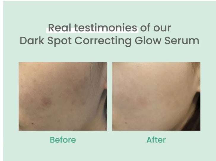 AXIS - Y - Dark Spot Correcting Glow Serum - Swiss K-POPup